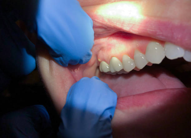 Best After-Hours Emergency Dentist in Vienna Bend, LA