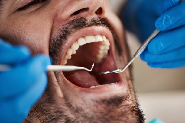 Best Pediatric Emergency Dentist in Vienna Bend, LA